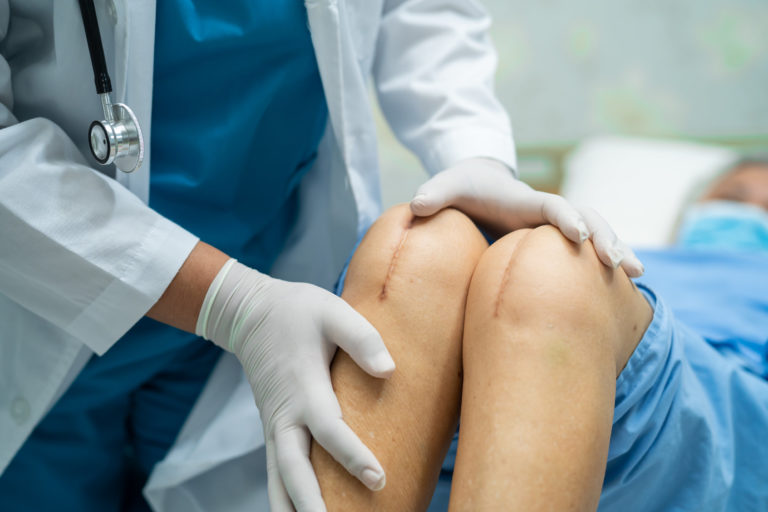 the-dangers-and-risks-of-putting-off-knee-replacement-surgery